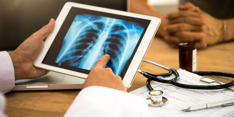 What type of Irregularities Can an X-Ray Detect?